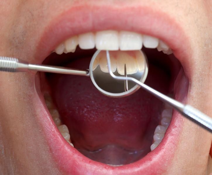 Badanie stanu zębów